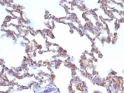 IHC testing of FFPE rat lung with Moesin antibody (clone MSN/491). Required HIER: boil tissue sections in 10mM citrate buffer, pH 6, for 10-20 min.