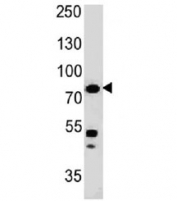 Western blot testing of human HT29 cell lysate with Moesin antibody (clone MSN/491). Predicted molecular weight ~68 kDa but routinely observed at 68-78 kDa.