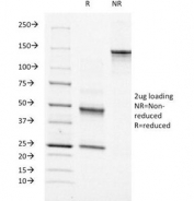 SDS-PAGE Analysis of Purified, BSA-Free Moesin Antibody (clone MSN/491). Confirmation of Integrity and Purity of the Antibody.
