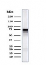 Western blot testing of human PC3 cell lysate with Moesin antibody (clone MSN/491). Predicted molecular weight ~68 kDa but routinely observed at 68-78 kDa.