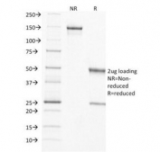 SDS-PAGE Analysis of Purified, BSA-Free TIMP-2 Antibody (clone 3A4). Confirmation of Integrity and Purity of the Antibody.