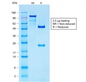 SDS-PAGE analysis of purified, BSA-free recombinant S100B antibody (clone S100B/1706R) as confirmation of integrity and purity.