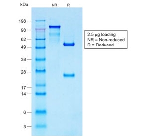 SDS-PAGE analysis of purified, BSA-free recombinant S100B antibody as confirmation of integrity and