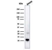 Western blot testing of human brain tissue lysate with recombinant S100B antibody. Predicted molecular weight ~11 kDa.