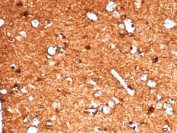 IHC testing of FFPE human brain tissue with recombinant S100B antibody. HIER: steam sections in pH 9 10mM Tris with 1mM EDTA for 10-20 min.