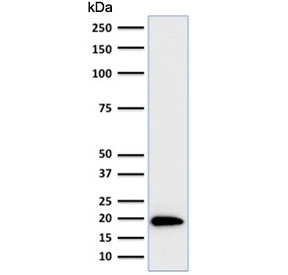 Western blot testing of human HeLa lysate with Ferritin Light Chain antibody (clone FTL/1386). Predicted molecular weight: ~20 kDa.