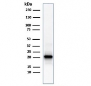 Western blot testing of human kidney lysate with recombinant FTL antibody (clone FTL/1386). Predicted molecular weight: ~20 kDa.