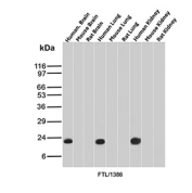Ferritin Light Chain Antibody for Western Blotting analysis of brain, lung, and kidney tissue lysates. Lane 1: human brain, Lane 2: mouse brain, Lane 3: rat brain, Lane 4: human lung, Lane 5: mouse lung, Lane 6: rat lung, Lane 7: human kidney, Lane 8: mouse kidney, Lane 9: rat kidney. A band is detected at approximately 20 kDa, consistent with the predicted molecular weight of Ferritin Light Chain / FTL. Clone FTL/1386 was used as the detecting antibody, demonstrating ferritin light chain expression across multiple mammalian tissues.