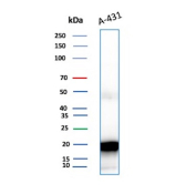 Ferritin Light Chain Antibody A-431 WB. Western blot analysis of A-431 cell lysate using Ferritin Light Chain Antibody detects a strong band at approximately 20 kDa, consistent with ferritin light chain / FTL. This western blotting antibody supports detection of the ferritin light chain subunit involved in intracellular iron storage, iron homeostasis, and oxidative stress-associated metabolic regulation pathways.