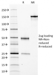 SDS-PAGE Analysis of Purified, BSA-Free Ferritin Light Chain Antibody (clone FTL/1388). Confirmation of Integrity and Purity of the Antibody.