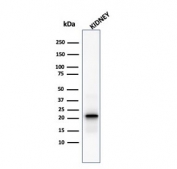 Western blot testing of human kidney lysate with Ferritin Light Chain antibody. Predicted molecular weight: ~20 kDa.