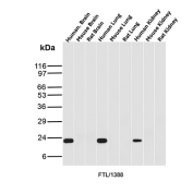 Ferritin Light Chain Antibody Multi-Tissue WB. Western blot analysis of human brain, mouse brain, rat brain, human lung, mouse lung, rat lung, human kidney, mouse kidney, and rat kidney tissue lysates using Ferritin Light Chain Antibody detects strong bands at approximately 20-24 kDa in human brain, human lung, and human kidney samples, consistent with ferritin light chain / FTL. The observed banding profile supports expression of this intracellular iron storage protein in metabolically active human tissues involved in iron homeostasis and oxidative stress regulation pathways.