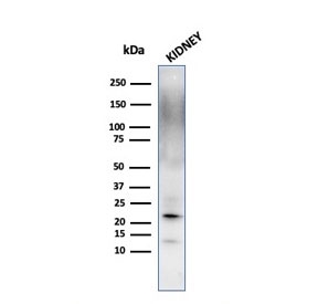 Western blot testing of human kidney lysate with Ferritin Light Chain antibody. Predicted molecular weight: ~20 kDa.~