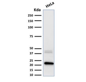 Western blot testing of human HeLa lysate with Ferritin Light Chain antibody. Predicted molecular weight: ~20 kDa.