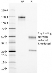 SDS-PAGE Analysis of Purified, BSA-Free Ferritin Light Chain Antibody (clone FTL/1389). Confirmation of Integrity and Purity of the Antibody.
