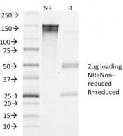 SDS-PAGE Analysis of Purified, BSA-Free LHR Antibody (clone LHCGR/1417). Confirmation of Integrity and Purity of the Antibody.