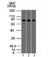 Western blot testing of human 1) A549, 2) HepG2 and 3) HCT-116 cell lysate with Villin antibody (clone VIL1/1314). Expected molecular weight ~93 kDa.