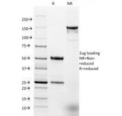 SDS-PAGE analysis of purified, BSA-free EpCAM antibody (clone EGP40/1384) as confirmation of integrity and purity.