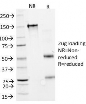 SDS-PAGE Analysis of Purified, BSA-Free Interferon alpha 2 Antibody (clone N27). Confirmation of Integrity and Purity of the Antibody.