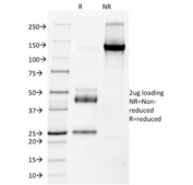 SDS-PAGE analysis of purified, BSA-free NKX2.2 antibody (clone NX2/1523) as confirmation of integrity and purity.