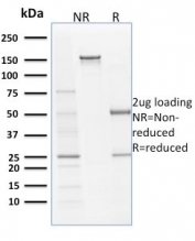SDS-PAGE analysis of purified, BSA-free Filaggrin antibody (clone SPM181) as confirmation of integrity and purity.