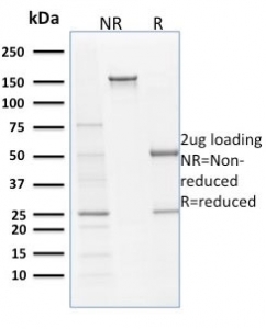 SDS-PAGE analysis of purified, BSA-free Filaggrin antibody (clone SPM181) as confi