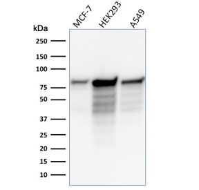 Western blot testing of human samples with MCM7 antibody (clone MCM7/1466). Expected molecular weight: 80-90 kDa.~