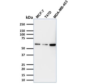 Western blot testing of human MCF-7, T-47D and MDA-MB-453 lysate with p63 antibody (clone TP63/1786). Expected molecular weight: 63-77 kDa.~