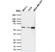 Western blot testing of human MCF-7, T-47D and MDA-MB-453 lysate with p63 antibody (clone TP63/1786). Expected molecular weight: 63-77 kDa.