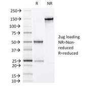 SDS-PAGE Analysis of Purified, BSA-Free Villin Antibody (clone VIL1/1325). Confirmation of Integrity and Purity of the Antibody.