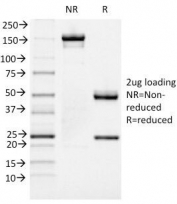 SDS-PAGE Analysis of Purified, BSA-Free FOXA1 Antibody (clone FOXA1/1519). Confirmation of Integrity and Purity of the Antibody.