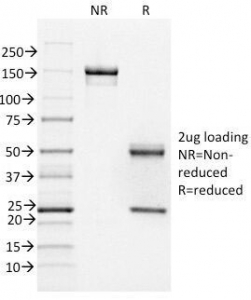 SDS-PAGE Analysis of Purified, BSA-Free FOXA1 Antibody (clone FOXA1/1518). Confirmation of Integrity and Purity of the Antibody.