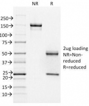 SDS-PAGE Analysis of Purified, BSA-Free FOXA1 Antibody (clone FOXA1/1518). Confirmation of Integrity and Purity of the Antibody.
