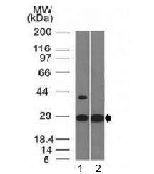 Western blot testing of with EPO antibody (clone EPO/1368). Predicted molecular weight: 18-34 kDa depending on glycosylation level.~