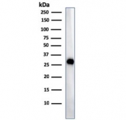 Western blot testing of human Ramos cell lysate with HLA-DP/DQ/DR antibody (clone CR3/43). Expected molecular weight ~36 kDa (alpha chain) and ~27 kDa (beta chain).