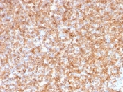 IHC testing of FFPE human tonsil tissue with HLA-DP/DQ/DR antibody (clone CR3/43). Required HIER: boil tissue sections in 10mM citrate buffer, pH 6, for 10-20 min.