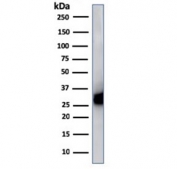 Western blot testing of human spleen cell lysate with HLA-DP/DQ/DR antibody (clone CR3/43). Expected molecular weight ~36 kDa (alpha chain) and ~27 kDa (beta chain).