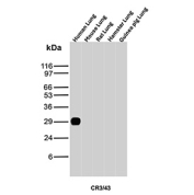 Western blot testing of various species lung tissue lysate with HLA-DP/DQ/DR antibody (clone CR3/43). Expected molecular weight ~36 kDa (alpha chain) and ~27 kDa (beta chain).