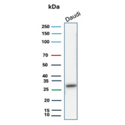 Western blot testing of human Daudi cell lysate with HLA-DP/DQ/DR antibody (clone CR3/43). Expected molecular weight ~36 kDa (alpha chain) and ~27 kDa (beta chain).