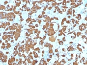 IHC testing of FFPE human pituitary gland with Growth Hormone antibody (clone SPM106). Required HIER: boil tissue sections in pH 9 10mM Tris with 1mM EDTA for 10-20 min.