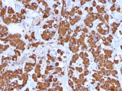 IHC testing of FFPE human pituitary gland with Growth Hormone antibody (clone GH/1371). Required HIER: boil tissue sections in pH 9 10mM Tris with 1mM EDTA for 10-20 min.