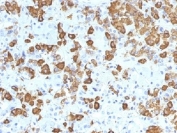 IHC testing of FFPE human pituitary gland with Growth Hormone antibody (clone GH/1371). Required HIER: boil tissue sections in pH 9 10mM Tris with 1mM EDTA for 10-20 min.