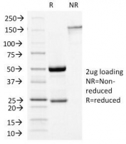SDS-PAGE Analysis of Purified, BSA-Free GH Antibody (clone GH/1450). Confirmation of Integrity and Purity of the Antibody.