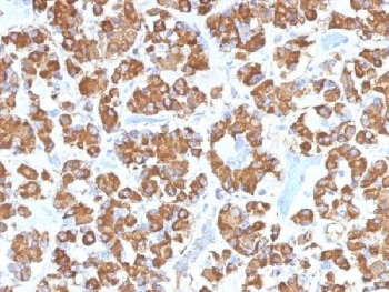 IHC testing of FFPE human pituitary gland with GH antibody (clone GH/1450). Required HIER: boil tissue sections in pH 9 10mM Tris with 1mM EDTA for 10-20 min.~