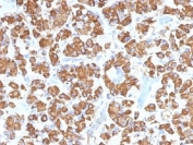 IHC testing of FFPE human pituitary gland with GH antibody (clone GH/1450). Required HIER: boil tissue sections in pH 9 10mM Tris with 1mM EDTA for 10-20 min.