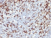 IHC testing of FFPE human tonsil with PD1 antibody. Required HIER: steam sections in 10mM Tris with 1mM EDTA, pH 9, for 10-20 min.