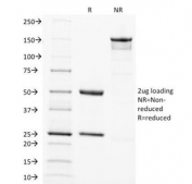 SDS-PAGE Analysis of Purified, BSA-Free SOX2 Antibody (clone SOX2/1792). Confirmation of Integrity and Purity of the Antibody.