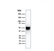 Western blot testing of human spleen lysate with Thymidine Phosphorylase antibody (clone SPM322). Predicted molecular weight ~55 kDa.