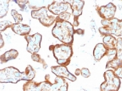 IHC testing of FFPE human placenta with Thymidine Phosphorylase antibody (clone SPM322). Required HIER: requires boil tissue sections in pH 9 10mM Tris with 1mM EDTA for 10-20 min followed by cooling at RT for 20 min.