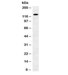 Western blot testing of human brain lysate with N-Cadherin antibody. Predicted molecular weight ~100 kDa (unmodified), 125-140 kDa (modified).~